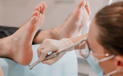 Quelles sont les solutions pour les talons fendillés et douloureux ?